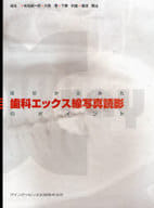 <<医学>> 症状からみた歯科エックス線写真読影のポイ / 有地榮一郎